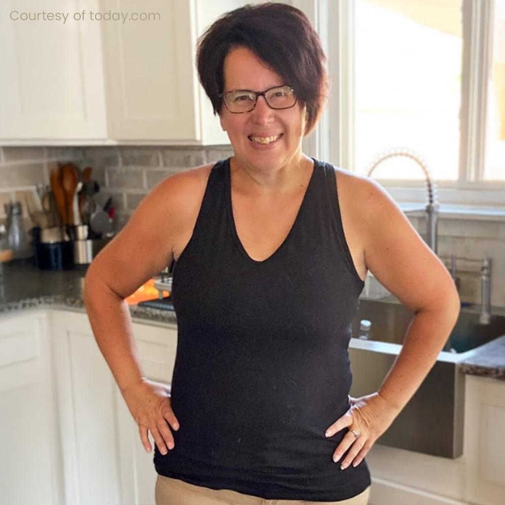 Weight loss patient before and after
