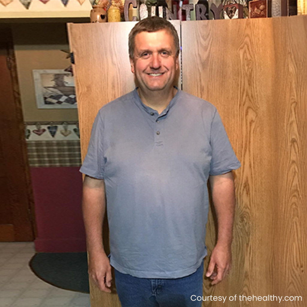 Weight loss patient before and after