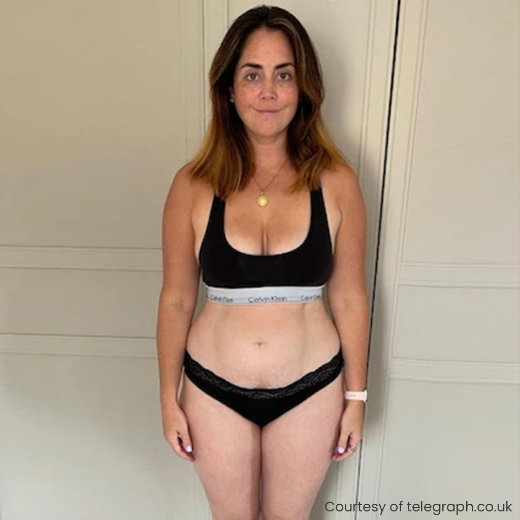 Weight loss patient before and after